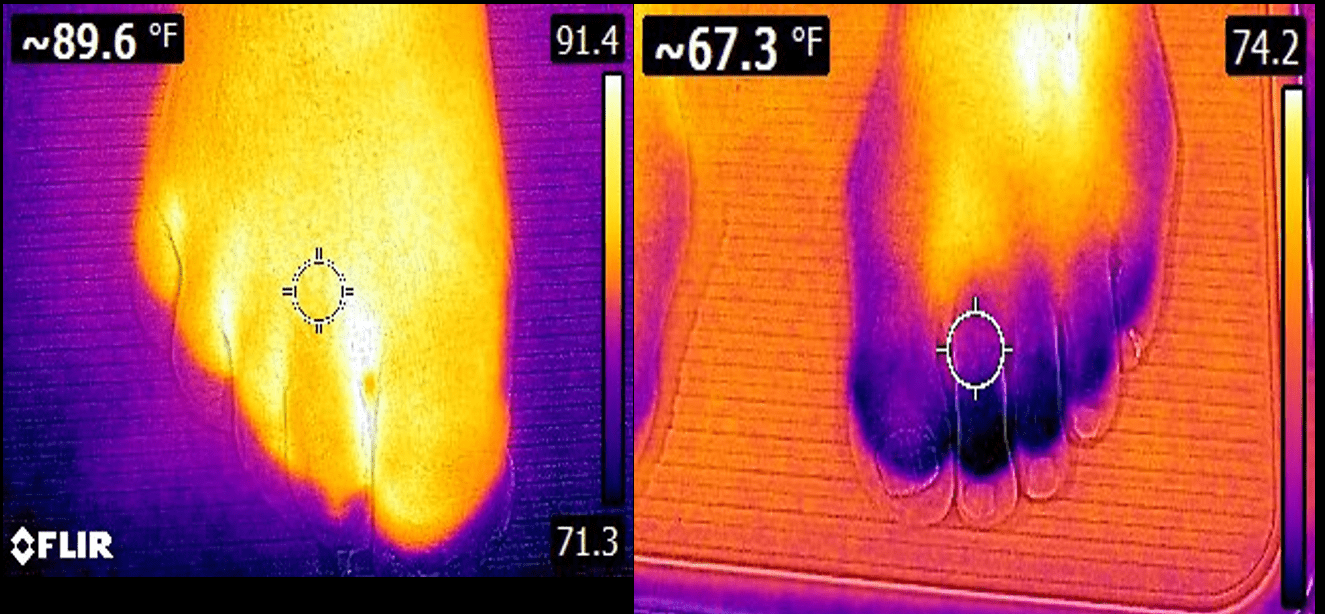 thermography results
